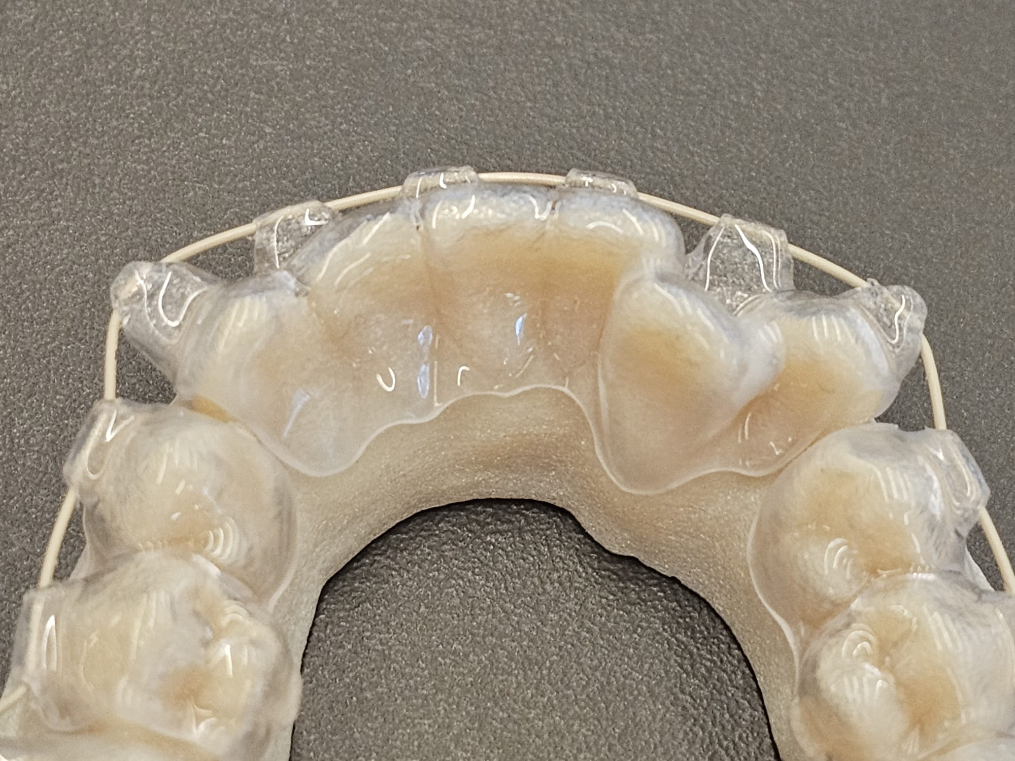 Invisalign